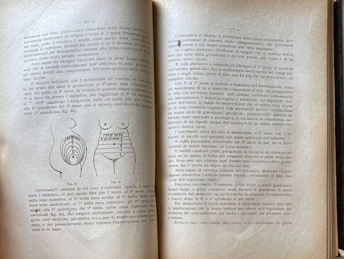 ERNESTO MADIA PRINCIPII MEDICINA LEGALE PSICHIATRIA FORENSE ANTROPOLOGIA 1921 - Picture 14 of 24