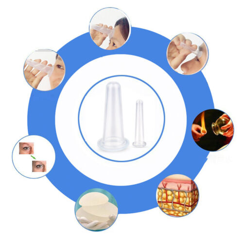 4er Set Silikon Gesicht Schröpfen Schröpfgläser Vakuum Schröpfkopf Massage Cups✅ - Bild 5 von 12