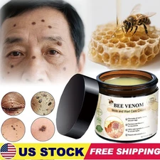 Bee Venom Skin Tag Removal Treatment Cream Body Care Mole Corn Wart Remover