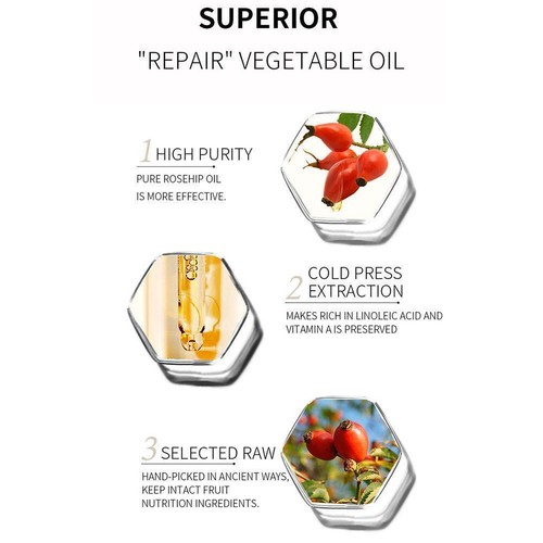 Rose fruit oil care essential oil U3U8 - Picture 10 of 11