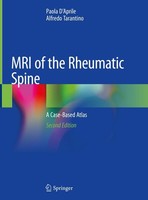 MRI Of The Rheumatic Spine Paola D'aprile