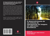 Asrani Lit (U. A.) | O Desenvolvimento De Um Sistema De SobreposiçãO De...