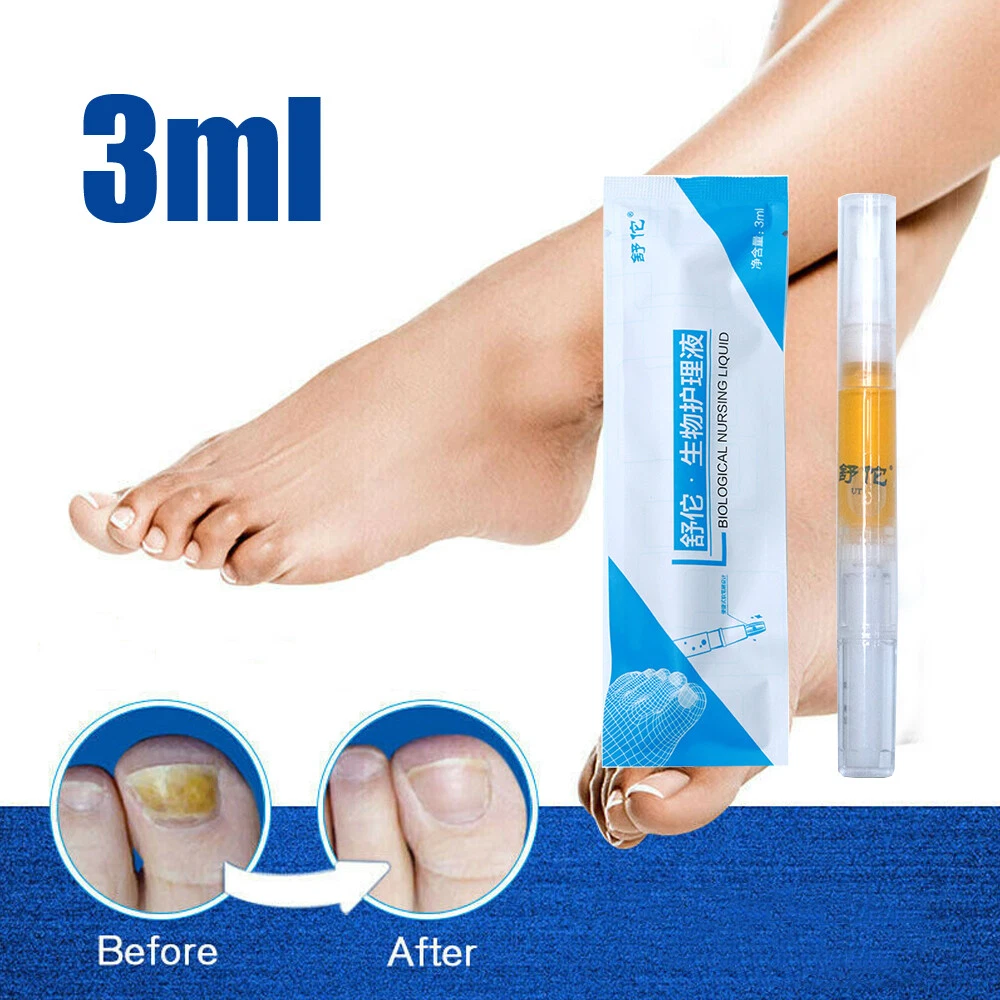 Discover 178+ tablets for fungal nail infection super hot nhuaanphu