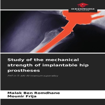 Study of the mechanical strength of implantable hip prostheses Ma