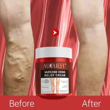 Varicose Veins Relief Cream Relieve Tired Legs Spider Pain Tighten Smooth Skin