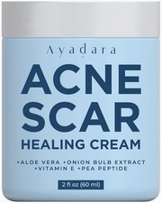 Acne Scar Healing Cream 2oz Face Body Stretch Marks Burns All Skin Types