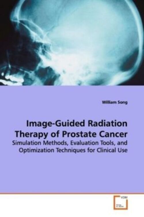 Thumbnail - William Song | Image-guided Radiation Therapy Of Prostate Cancer |