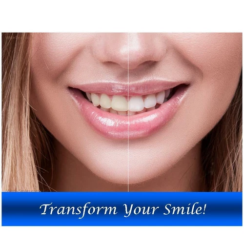 TEETH WHITENING GEL PROFESSIONAL STRONG WHITENER FOR SALON /HOME LED LASER LIGHT - Picture 7 of 24