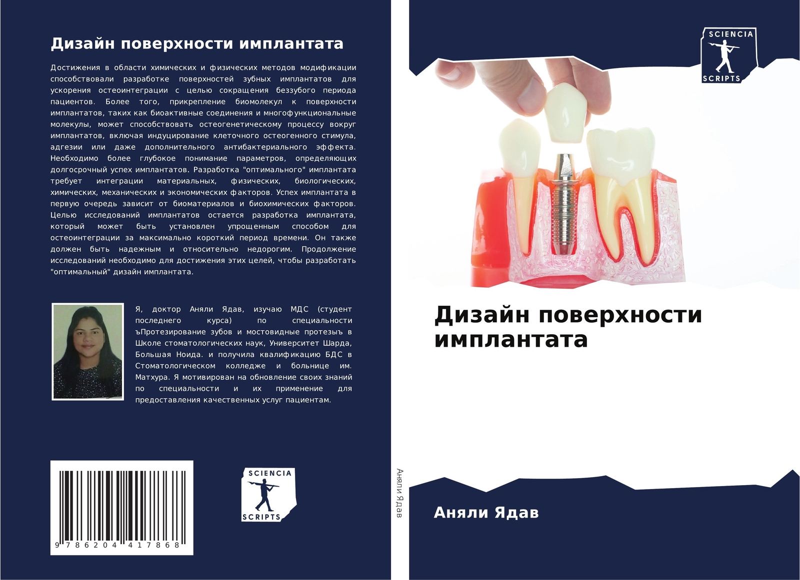 Thumbnail - Dizajn Powerhnosti Implantata | Anqli Yadaw | Russisch | Taschenbuch |