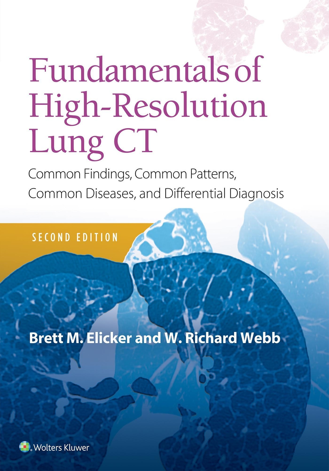 Thumbnail - Fundamentals Of High-resolution Lung Ct, Brett M. Elicker