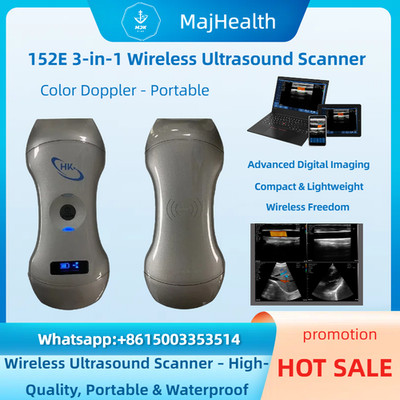 152E 3-in-1 Wireless Ultrasound Scanner w/Color Doppler - Portable