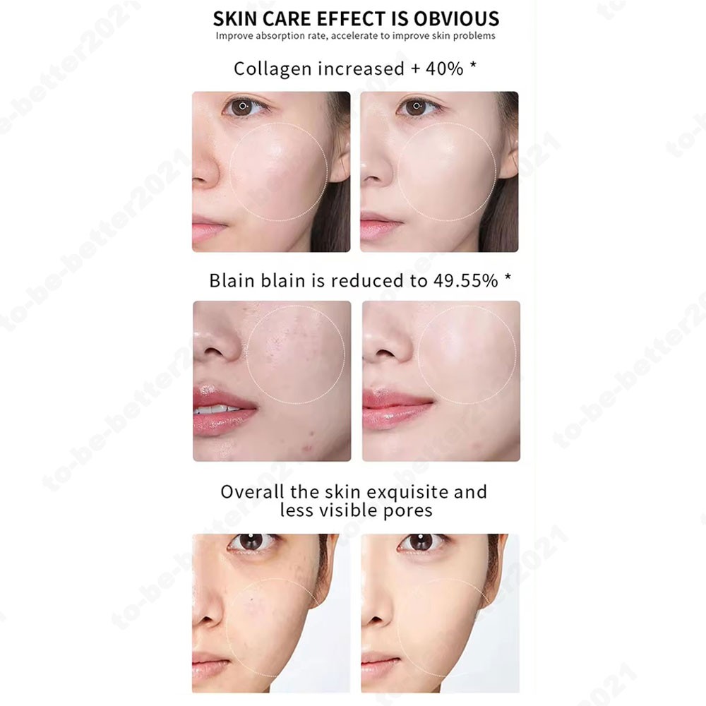 Portable Micro Pen Wrinkle Removal Skin Rejuvenation Machine Anti-Age for Face