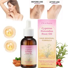NEW Cyperus Rotundus Oil - 60ml Natural Cyperus Rotundus Oil For Hair Removal