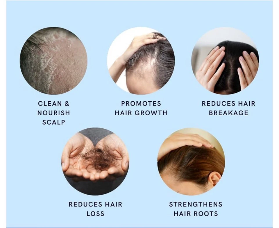 10in1 Minoxidil 5% Shampoo w/ Saw palmetto DHT Blocker Rosemary Bergamot Biotin - Image 2 of 4