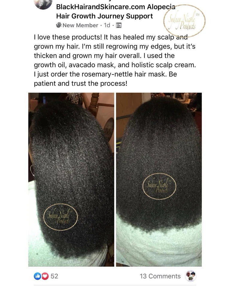 средства для роста волос для женщин - Изображение 2 из 3