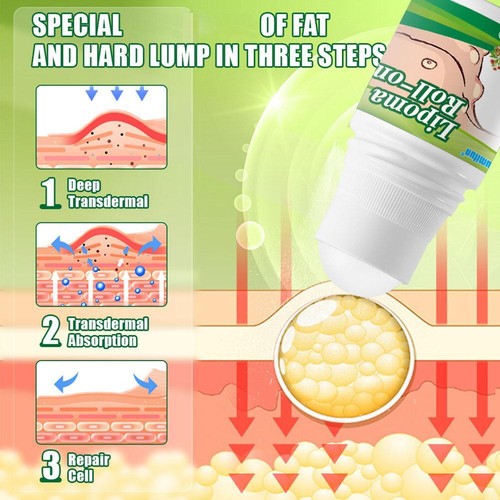 30ml Lipomas Cream Cleansing Skin Swelling Cellulite Ointment Skin Care Products - Picture 5 of 10
