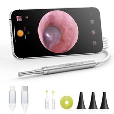 AnyScope Digital Otoscope Compatible with iPhone and Android Devices, HD Ear ...