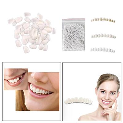 Obere & untere Prothese Zähne Veneers provisorische Zähne Kosmetik Zahnabdeckung