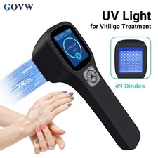 Medical Grade 308nm Excimer Light Therapy Handheld Portable for Skin Treatment