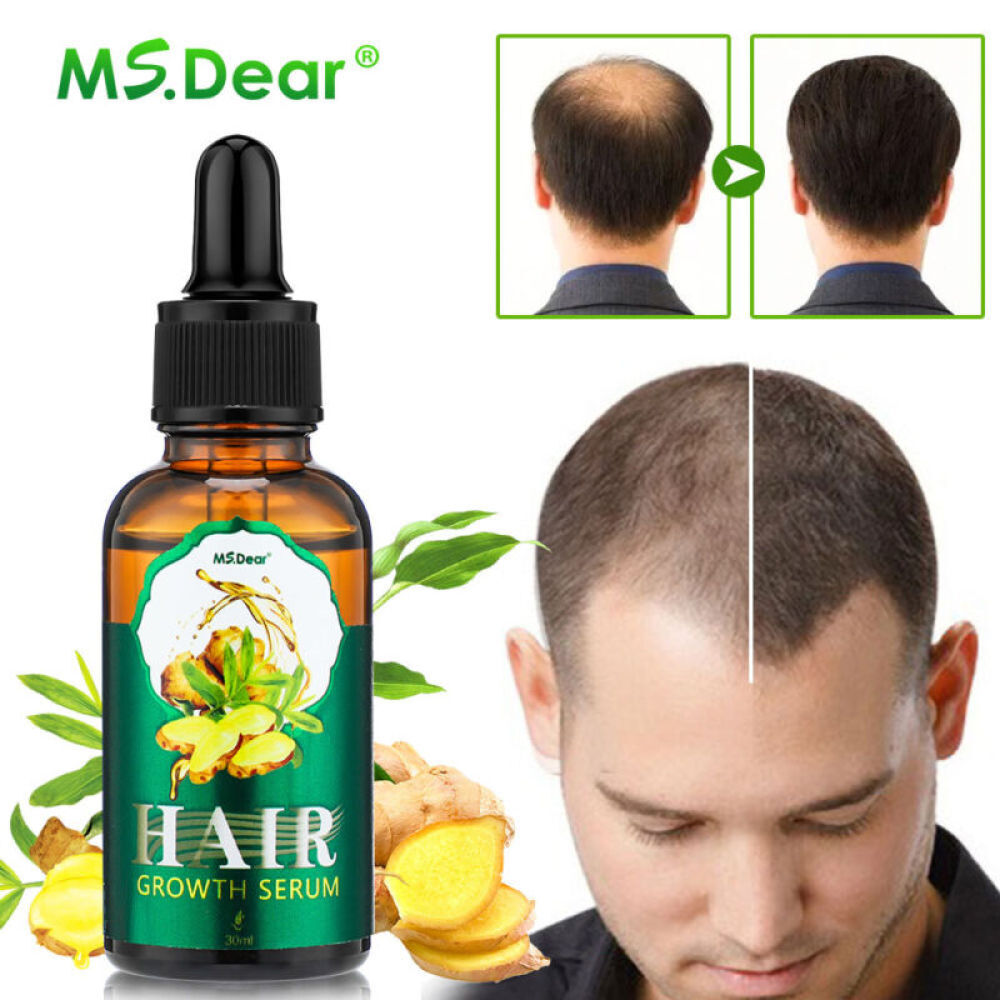 HyunGang Korea Ginger Hair Growth Serum - 30ml Anti-Hair Loss Treatment With Natural Ginger Extract - Dense Regrowth Oil 3 thumbnail image