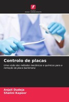 Anjali Dudeja (U. A.) | Controlo De Placas | Taschenbuch | Portugiesisch (2022)
