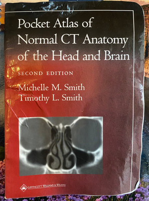 Pocket Atlas of Normal CT Anatomy of the Head and Brain (Radiology Pocket At...