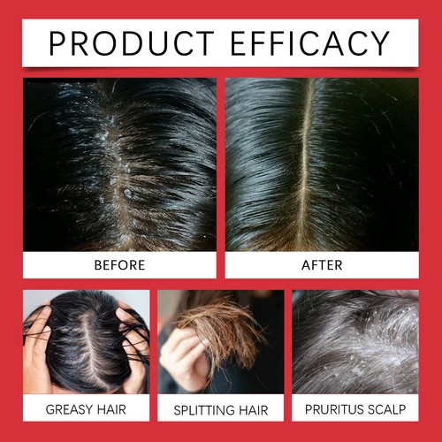 Exfoliating Scalp Scrub Shampoo with Tumeric & Avocado Oil 200ml - Picture 5 of 8