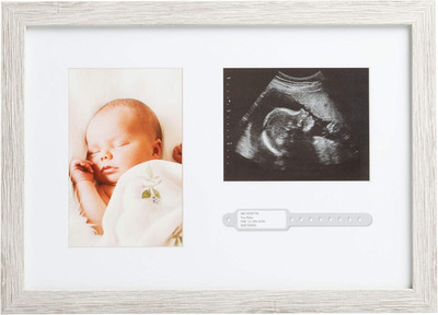 Kate & Milo Rustic Baby Keepsake Frame with Sonogram, Photo and Hospital ID Brac