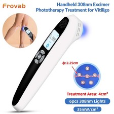 308nm Narrowband UVB Light Therapy Device for Localized Skin Conditions 35mW/cm 