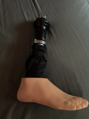 Harmony P3 Prosthetic Vacuum Suspension System with Foot Shell