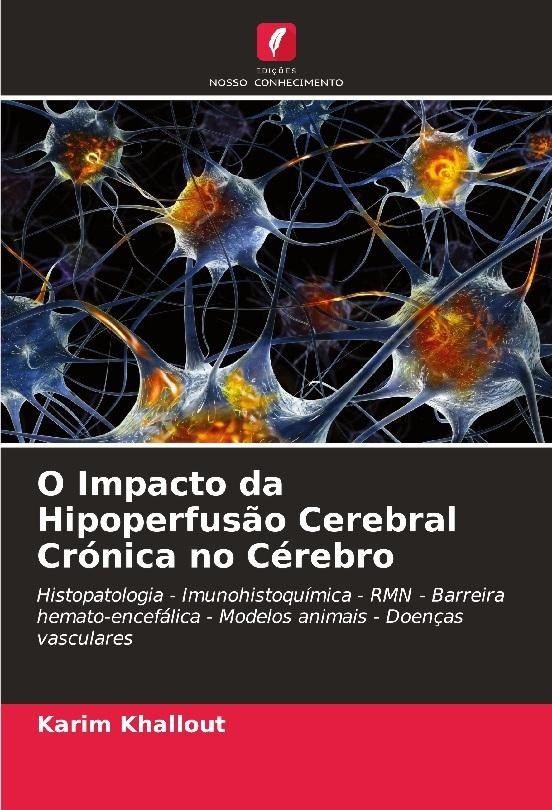 O Impacto da Hipoperfusão Cerebral Crónica no Cérebro Karim Khallout - Karim Khallout