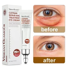 Magic Anti-Aging Eye Cream Reduce Dark Circles Puffiness Under Eye Bags Wrinkle