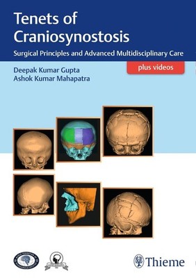 Tenets of Craniosynostosis Deepak Gupta