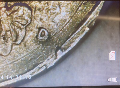 1986 D Quarter Obverse Edge- 2 Strike Errors (See Pics)