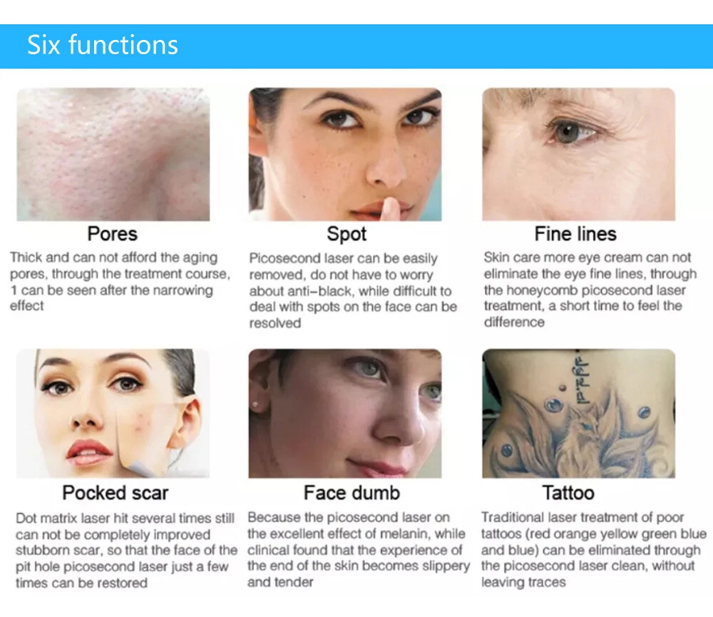 Open-box Picosecond Laser Tattoo Removal Machine Pigment Pico Skin Rejuvenation - product detail image 14
