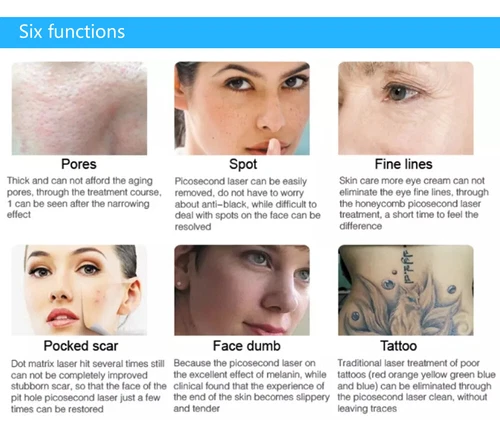 Open-box Picosecond Laser Tattoo Removal Machine Pigment Pico Skin Rejuvenation image 14