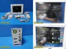 Spacelabs 91370 Ultraview SL Monitor W/ Patient Leads & 91496 Module ~ 29588