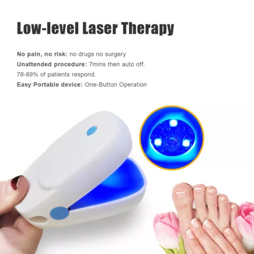 Nail Fungus Treatment For Toe & Finger Nail Fungal Infections Cold Laser Device