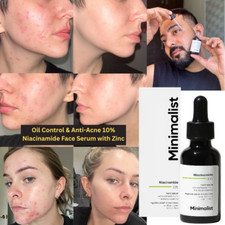 Minimalist 10 Niacinamide Face Serum with Zinc For Oil Control  Anti-Acne 30ML