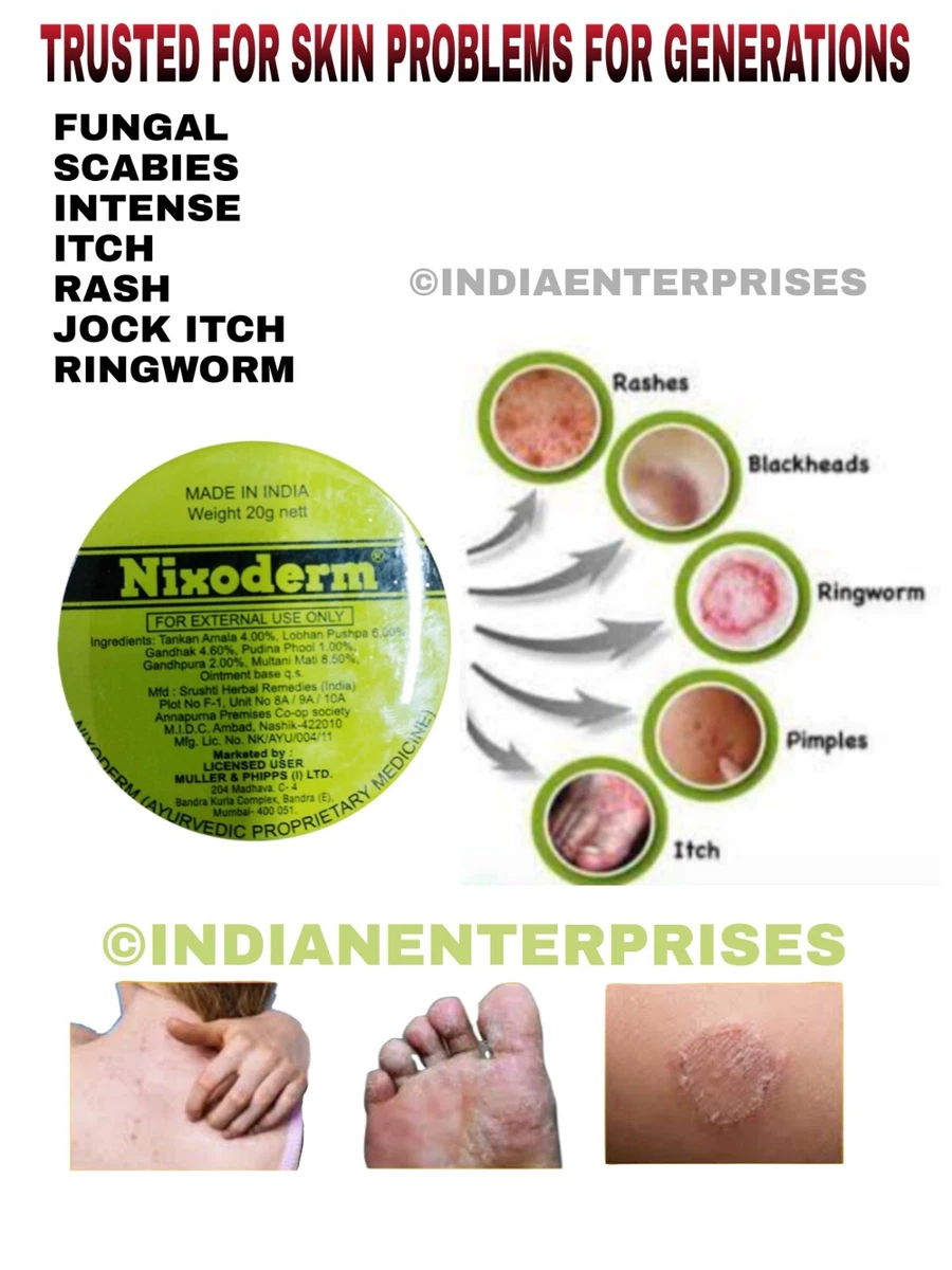 Jock Itch Fungus jock-itch-fungus