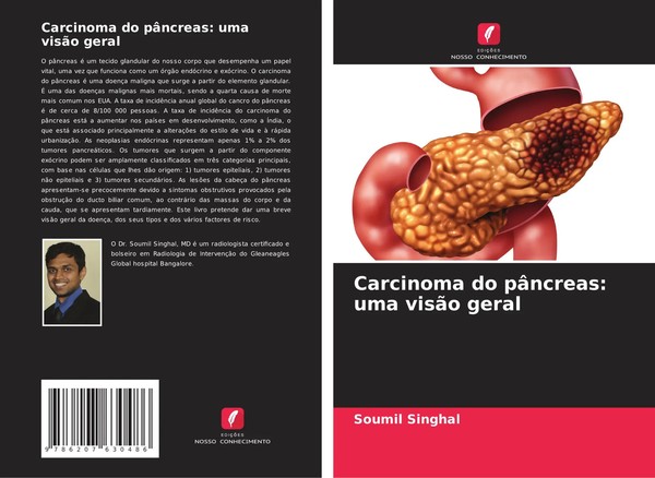 Carcinoma Do PâNcreas: Uma VisãO Geral Soumil Singhal Taschenbuch Portugiesisch-image
