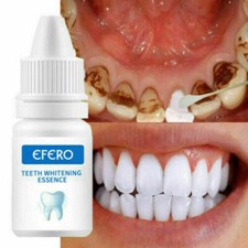 Teeth Whitening Powder Toothpaste Powder Cleaning Effective Remover Tooth Stains