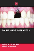 Deeksha Chaudhary (U. A.) | Falhas NOS Implantes | Taschenbuch | Portugiesisch