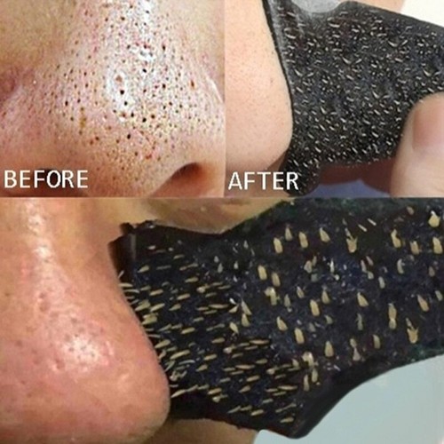 5/10/50/100pcs Blackhead Remover Nose Pore Cleansing Strip Peel Off Mask Sticker - Picture 23 of 32