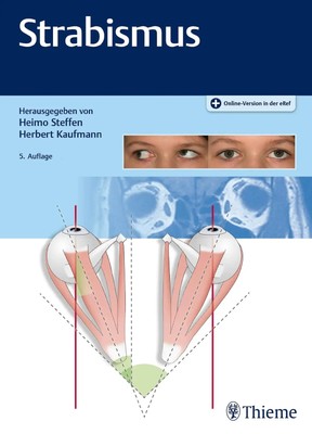 Herbert Kaufmann (u. a.) | Strabismus | Bundle | Deutsch (2020) | 1 Buch