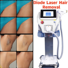 Ice Titanium 755 808 1064nm Permanent Painless Diode Laser hair removal Machine
