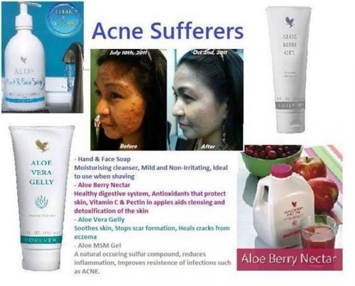 LOT of 6 Forever Living Aloe Vera GELLY (84,82% contents of ALOE VERA) 4 fl.oz - Picture 3 of 4