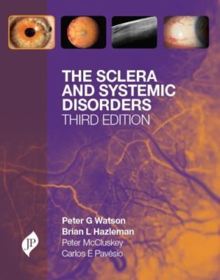 Sclera and Systemic Disorders, Hardcover by Watson, Peter G.; Hazleman, Brian...