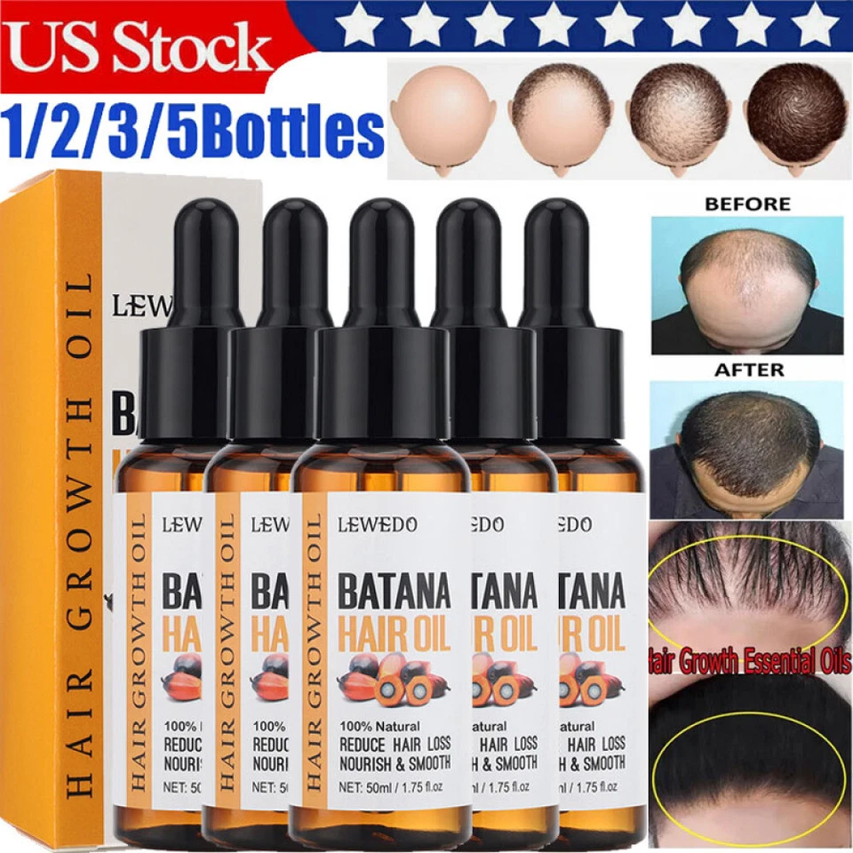 Aceite de Batana Natural 5/3X para el Crecimiento del Cabello, Aceite de Batana Orgánico, Reparar Cabello Dañado Foto 3 de 4