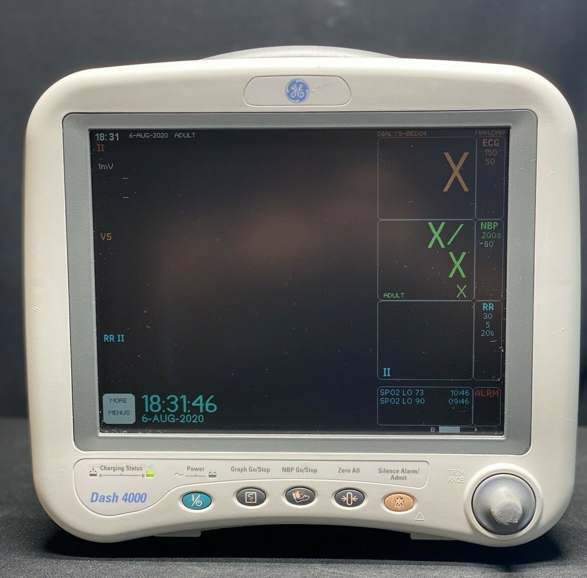 GE Dash 4000 Patient Monitor Ohmeda Spo2 + ECG + NIBP + Printer